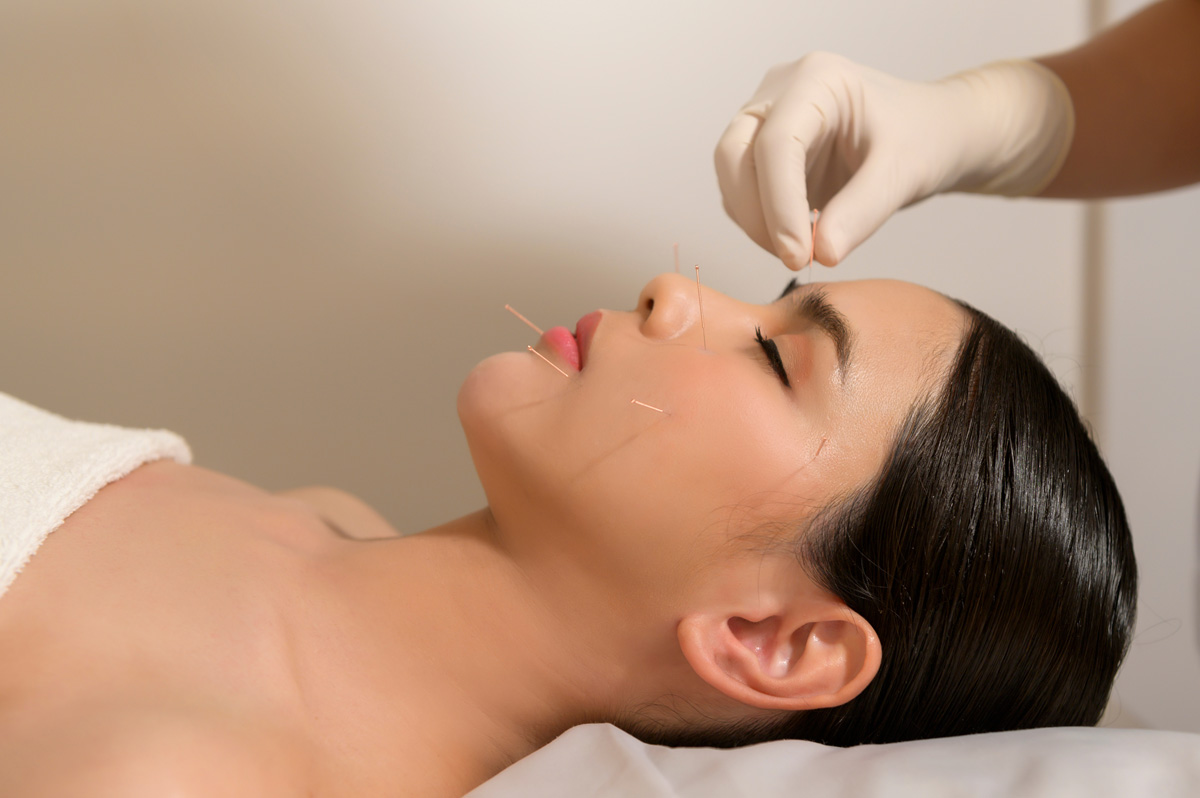 Woman at spa receiving facial acupuncture